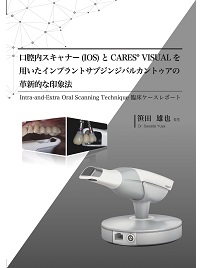 口腔内スキャナー(IOS)とCARES® VISUALを用いたインプラントサブジンジバルカントゥアの革新的な印象法 