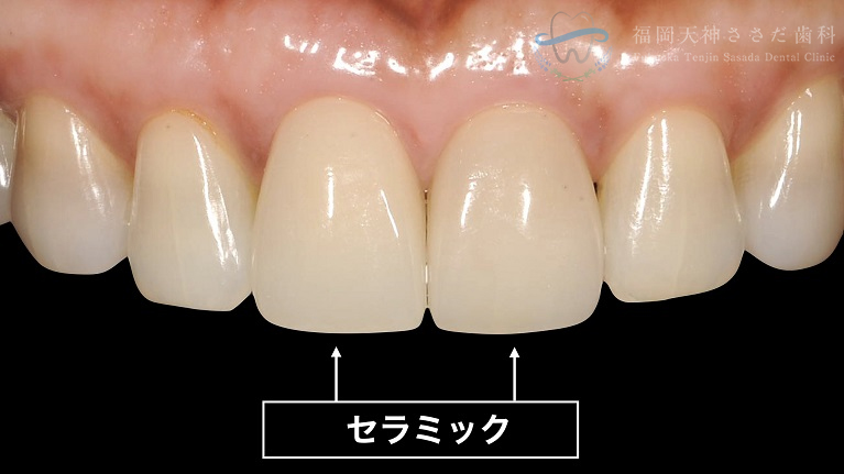 治療後の解説