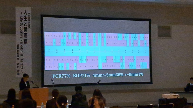 11月19日（日）臨床歯周病学会九州支部 歯科衛生士講演にて、当院の歯科衛生士 坂本が講演しました。