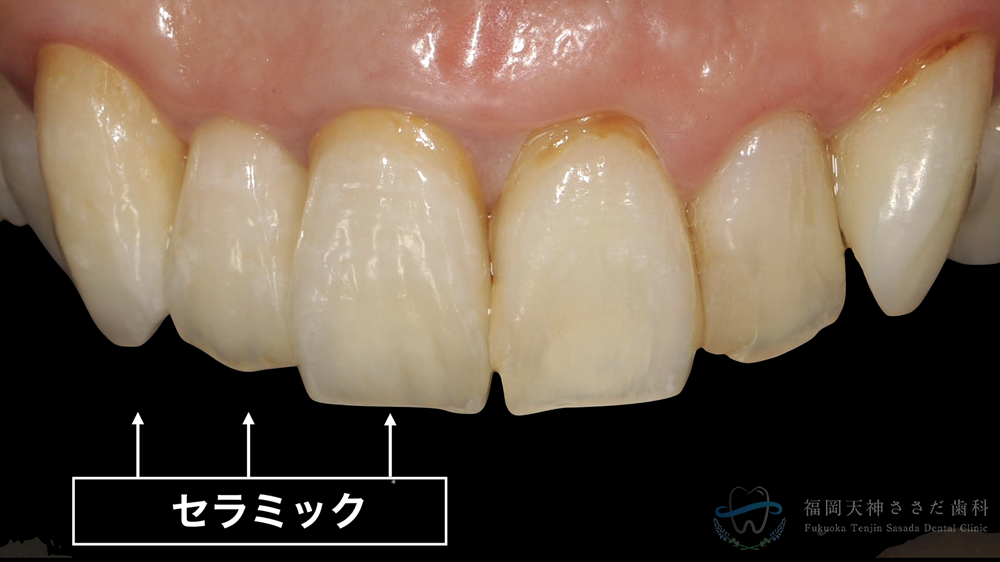 Case15_治療後の解説