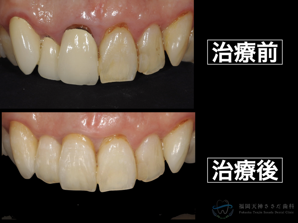 Case_治療前後の比較