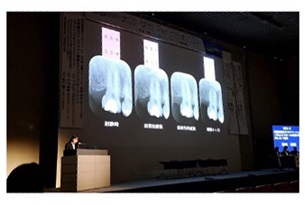 特徴①日本臨床歯周病学会、日本歯周病学会認定歯科衛生士取得制