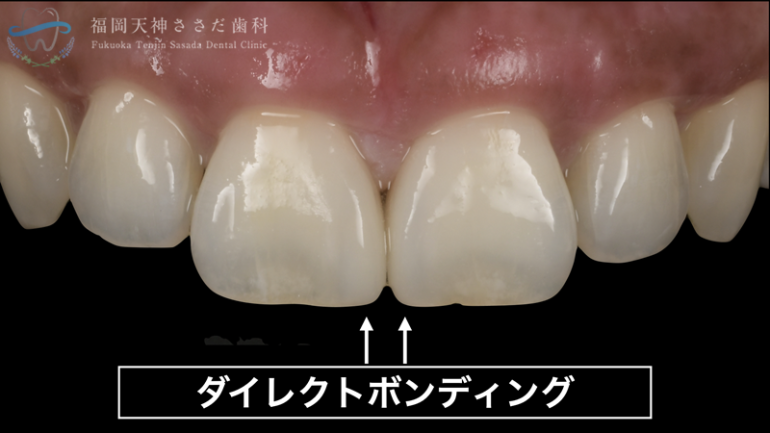 治療後の解説