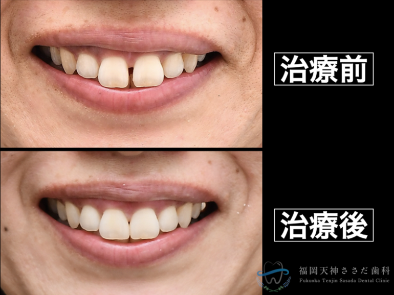 治療前後の比較２