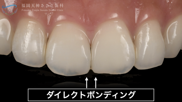 治療後の解説