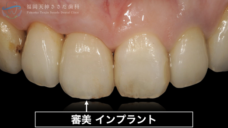 治療後の解説