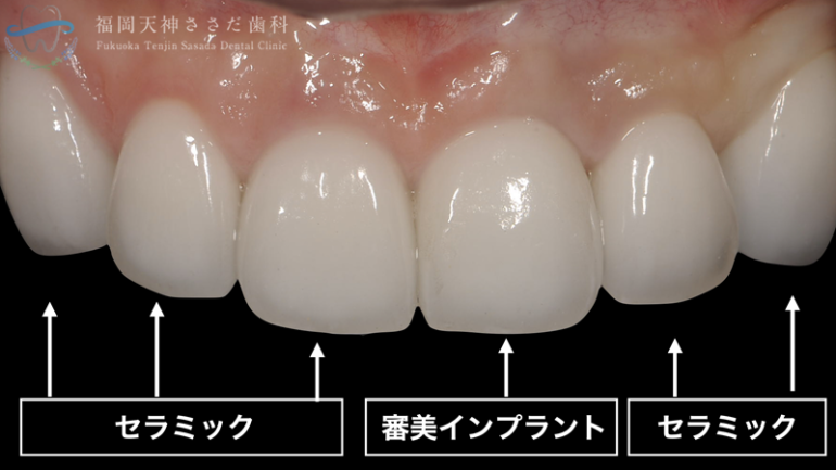 治療後の解説