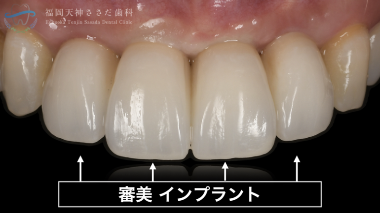 治療後の解説